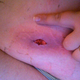 Image for article titled 10 Of The Grossest Stories You'll Ever Read